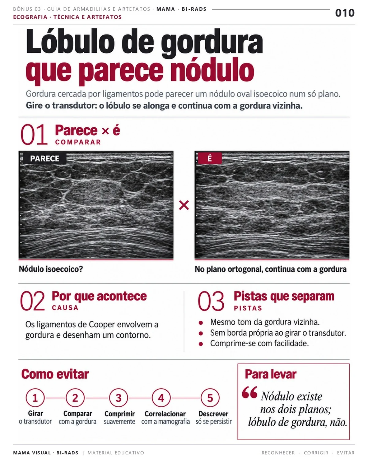 Página 10: Lóbulo de gordura que parece nódulo. Prévia do PDF Mama Visual BI-RADS; imagens didáticas simuladas.