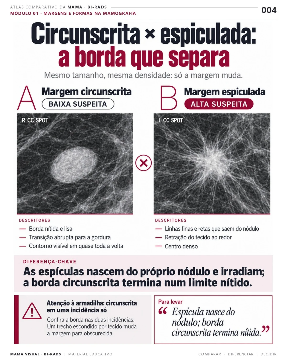 Página 4 do Atlas: margem circunscrita e espiculada, em comparação didática