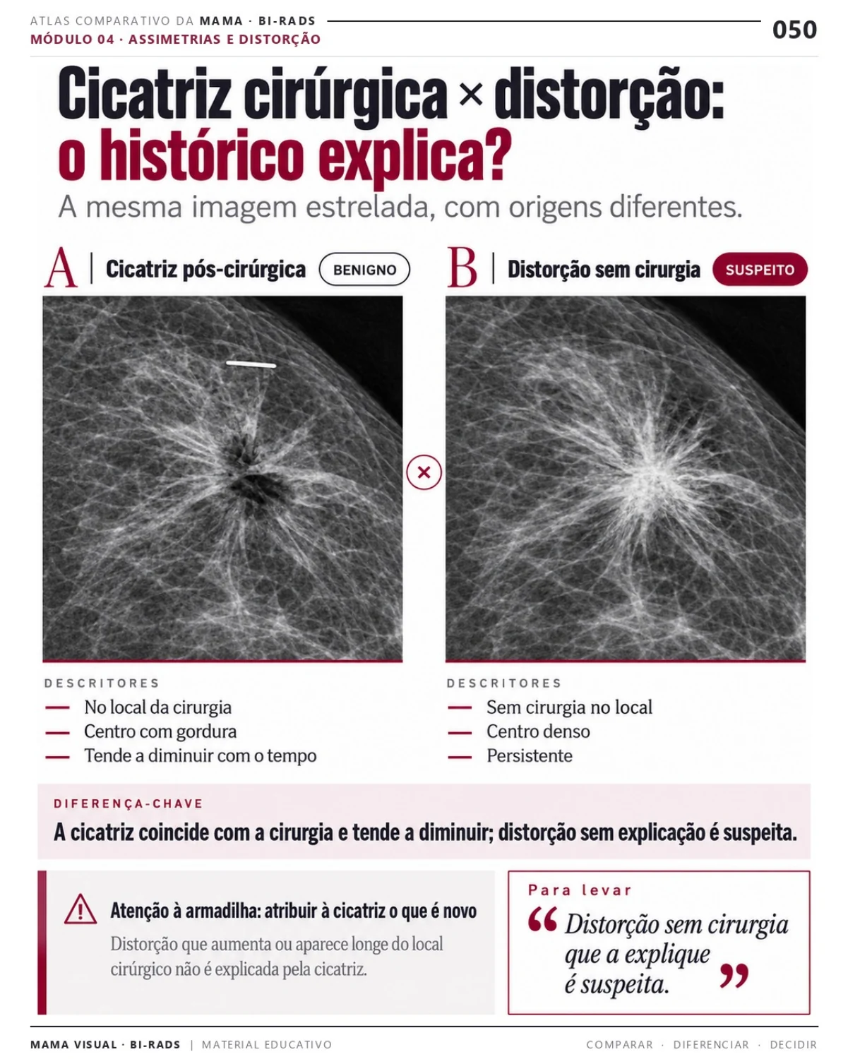 Página 50: Cicatriz cirúrgica × distorção. Prévia do PDF Mama Visual BI-RADS; imagens didáticas simuladas.