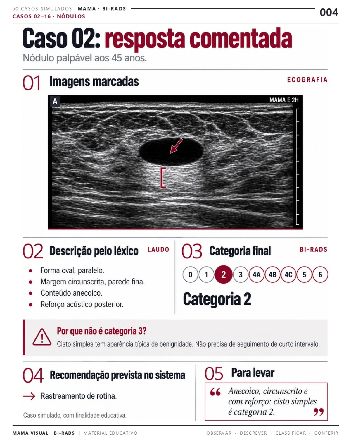 Página 4: Caso 02: resposta comentada. Prévia do PDF Mama Visual BI-RADS; imagens didáticas simuladas.