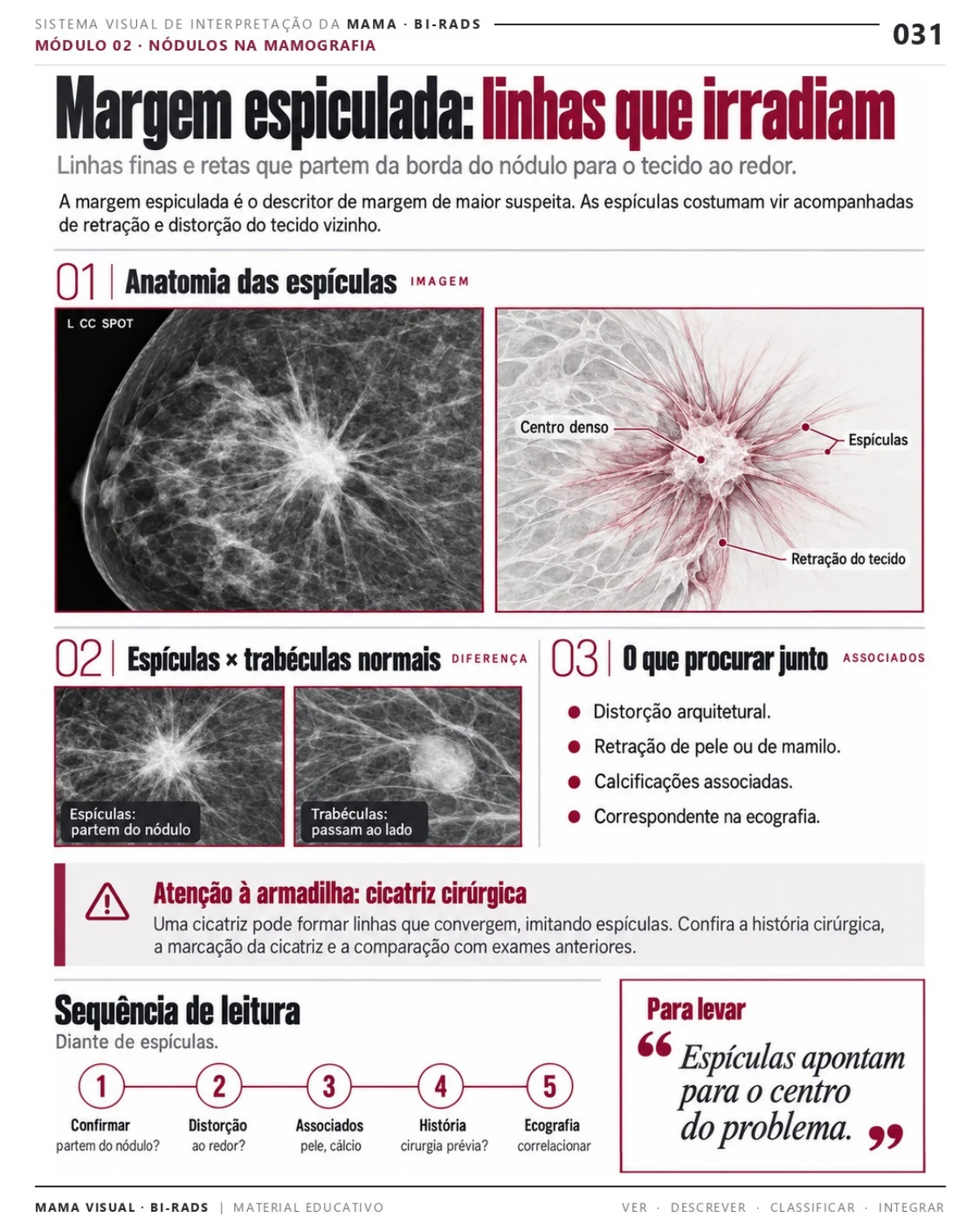 Página 31: Margem espiculada: linhas que irradiam. Prévia do PDF Mama Visual BI-RADS; imagens didáticas simuladas.